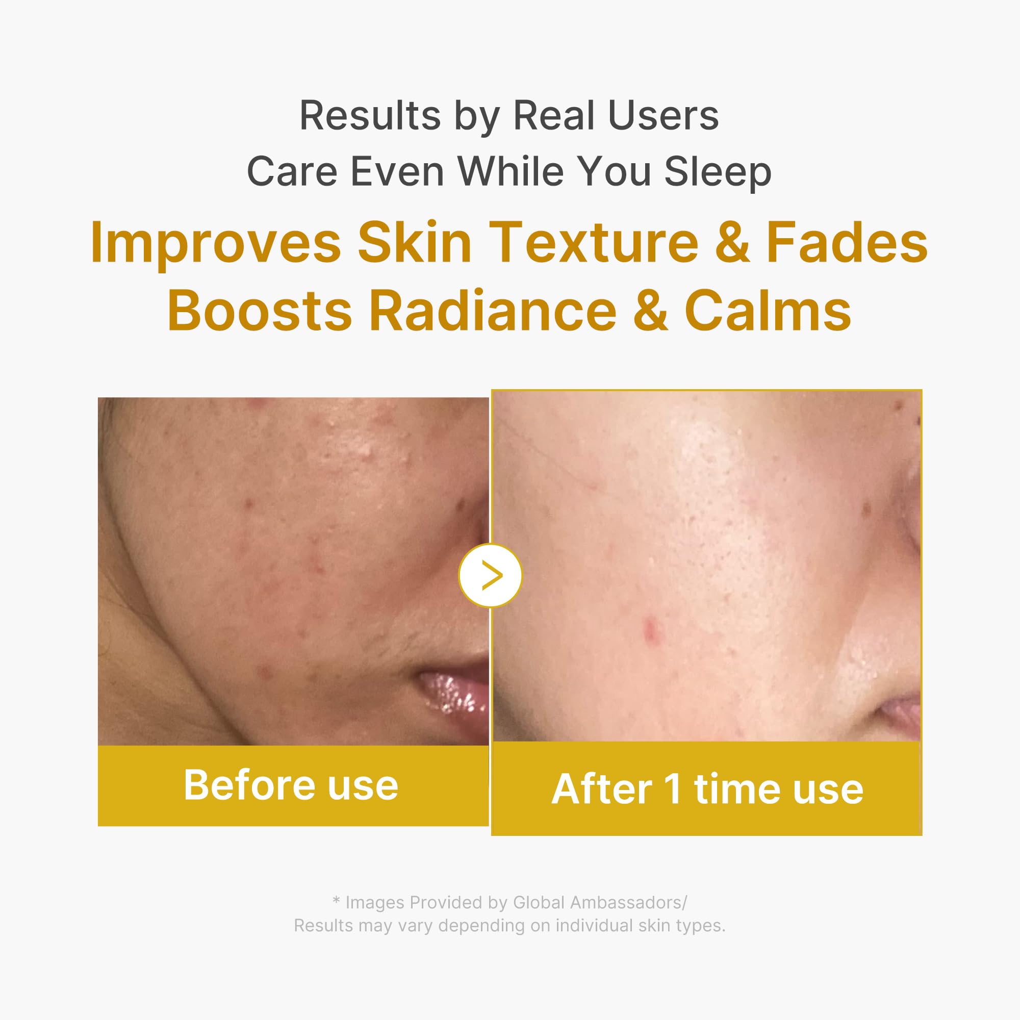 Medicube Wrapping Mask Collagen Overnight Peel Off Facial Mask | Elasticity & Hydration Care, Reduces Sagging & Dullness | Hydrolyzed Collagen For Glowing Skin